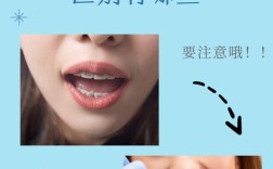 牙齿正畸治疗矫正过程中，是否所有人都必须佩戴牙套呢？