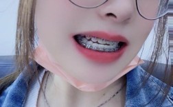 35岁矫正牙齿晚不晚？中年变美还有机会吗？