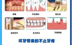 矫正牙齿期间，拔掉蛀牙可以吗？需要拔除吗？