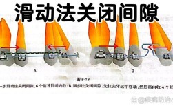正畸中拉牙齿间隙的方法有哪些步骤和技巧？