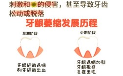 牙龈萎缩手术治疗方法