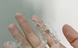 隐形牙齿矫正适合哪些人群？适用条件有哪些？