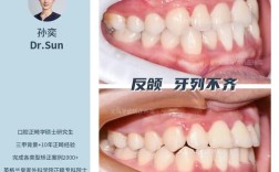 牙齿错位矫正案例中矫正效果如何体现？