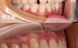 上海牙齿矫正最好怎么选？关键评判标准有哪些？