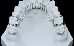 正畸弓丝自带停止扣有何优势？能否提升矫治精准度？