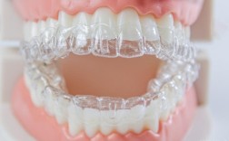 edgewise正畸，矫正牙齿的独特优势是什么？