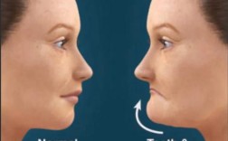 成都LH正畸法效果如何？适合哪些牙齿矫正需求？