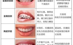 矫正牙齿有哪些方法？如何选择适合自己的？