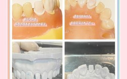 基牙预备常用方法有哪些？操作步骤及临床注意事项是什么？