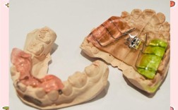 正畸用什么的好