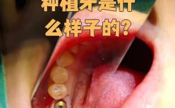 种牙像真的真牙一样吗