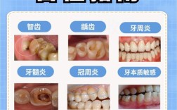牙疼发作时如何及时止痛？快速缓解的有效方法有哪些？