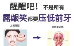 如何压低上前牙？有哪些常用方法？