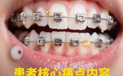 宜昌矫正牙齿哪里便宜又好？求性价比高的正规机构推荐