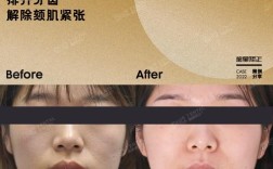 周博士牙齿矫正