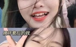 贵阳哪里做牙齿矫正靠谱？医院资质、医生技术和价格怎么选？