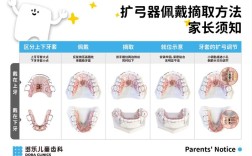 活动扩弓器加力方法有哪些关键操作步骤？