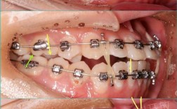 矫正牙齿什么地方好