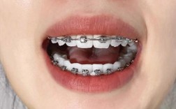 连江牙齿矫正多少钱？效果好不好？医生专业吗？