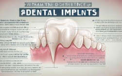 种植牙的缺点究竟有哪些？材料、费用、手术及术后风险你清楚吗？