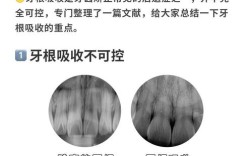正畸口腔拍照教学文献的核心拍摄教学要点有哪些？