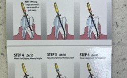 牙科机扩的正确使用方法具体步骤有哪些？