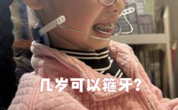 儿童牙齿矫正的黄金年龄是几岁？