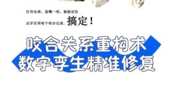 咬合关系转移的方法