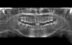 矫正牙齿没有拍片