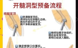 右上6根管表示方法