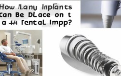 2025最新，种植牙上到底能种几颗？数量有上限吗？