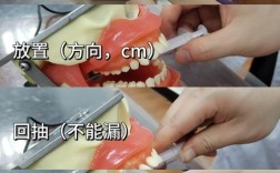 种牙常用的麻醉方法有哪些？如何选择合适麻醉？