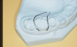 正畸单臂卡的弯制步骤