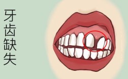 缺牙多年未补牙，现在想种牙还来得及吗？牙槽骨条件差会影响种牙效果吗？