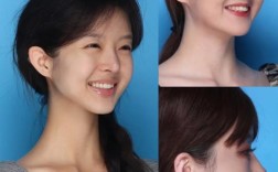 矫正牙齿改变脸型？是真是假？真相如何？
