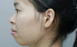 矫正牙齿后嘴巴突出，是矫正效果问题吗？原因是什么？