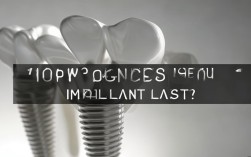 2025种植牙寿命最新解答，到底能用多少年？