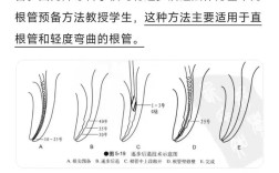 大锥度根管治疗预备方法