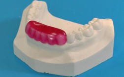 上颌斜导在口腔正畸中制作的关键步骤和材料选择是什么？