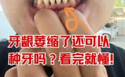 没牙龈能种牙吗