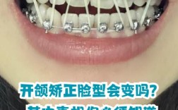 牙齿正畸影响咬合吗