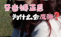 牙齿矫正会改变鼻子