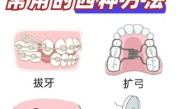 正畸滑动回收间隙的方法如何实现精准间隙控制？