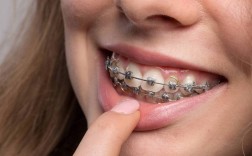 矫正牙齿能突嘴