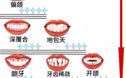 正畸中的面型分类