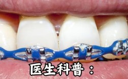 矫正牙齿以后会松动吗