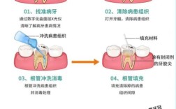 根管预备有哪些方法？如何确保预备效果与安全？