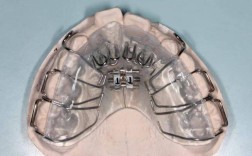 肌功能矫治器正畸图片能直观展示哪些不同矫正作用、效果及适用人群？