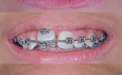 北京矫正牙齿哪里好？求推荐靠谱机构？