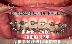 颌面畸形患者能顺利种牙吗？